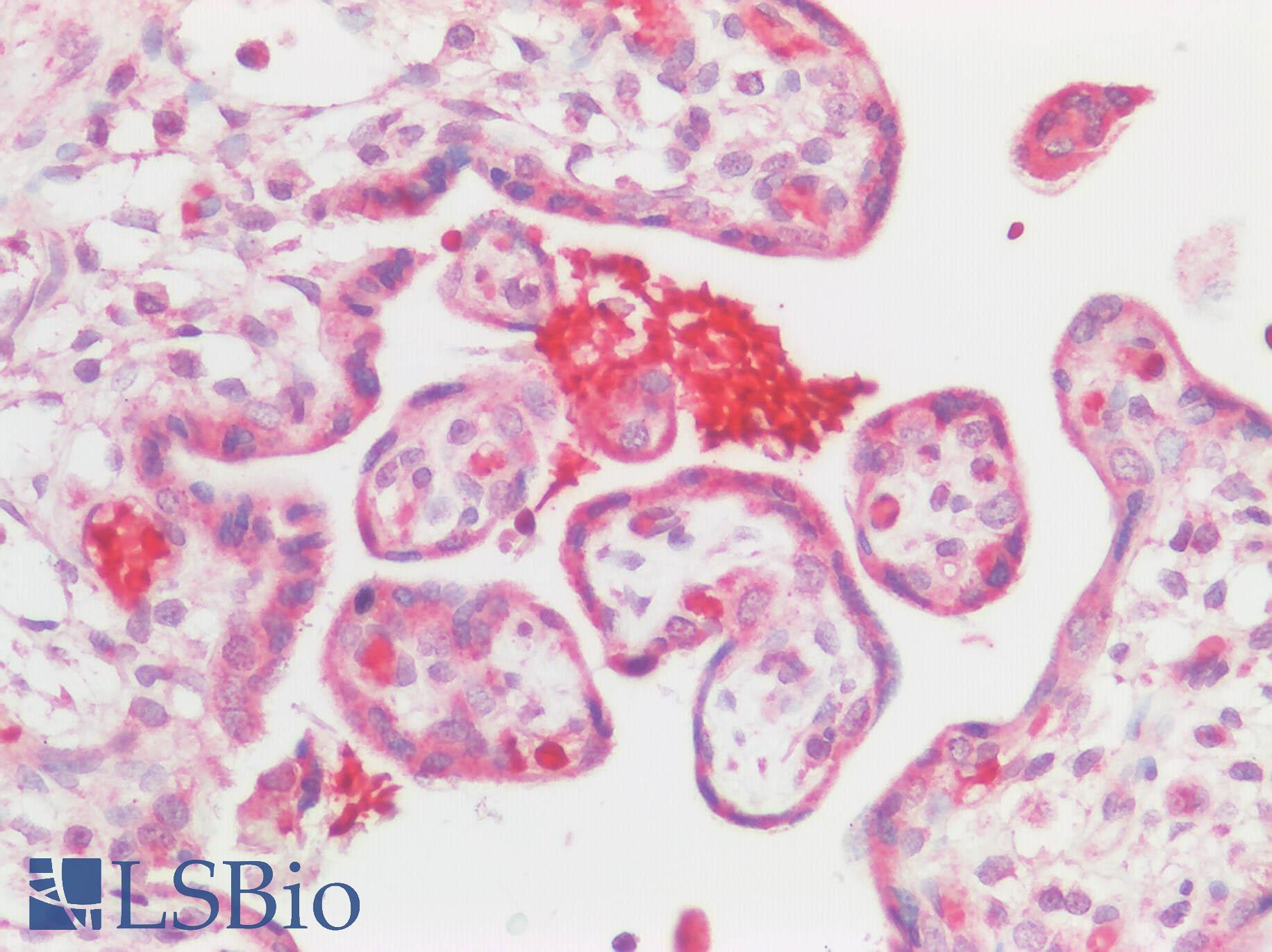 BMP6 Antibody - Human Placenta: Formalin-Fixed, Paraffin-Embedded (FFPE)