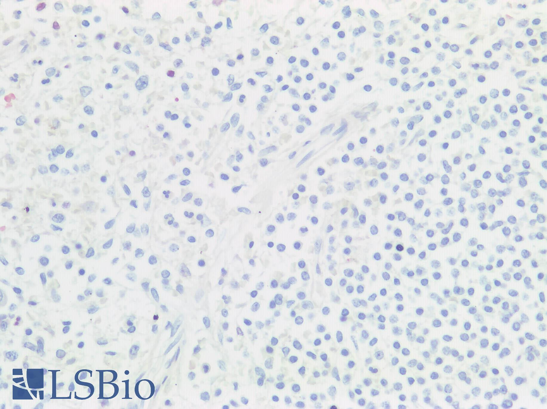 BMP6 Antibody - Human Spleen: Formalin-Fixed, Paraffin-Embedded (FFPE)