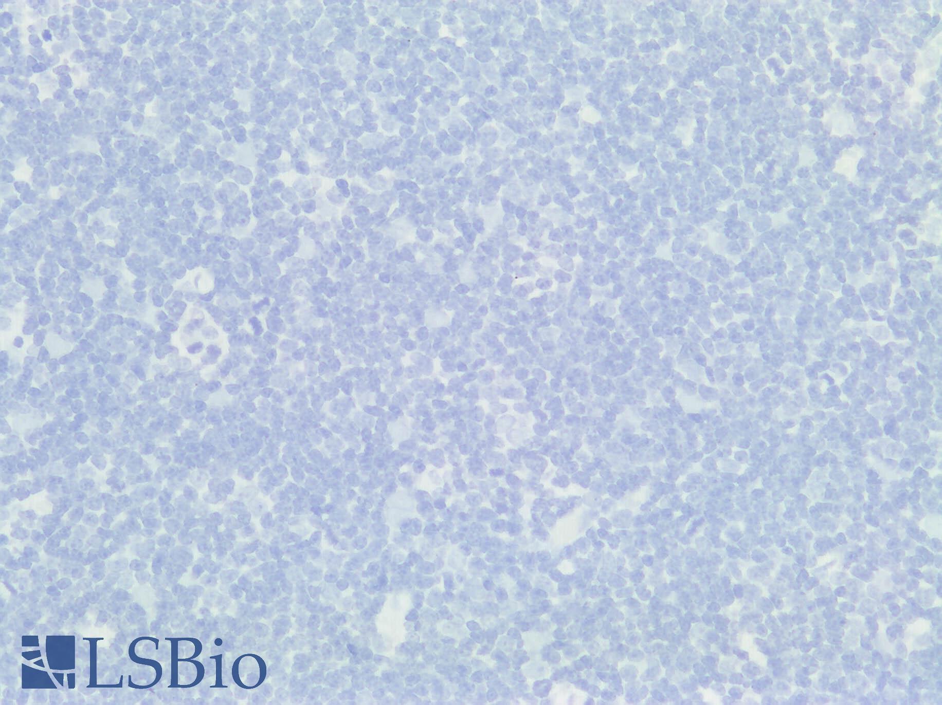 BMP6 Antibody - Human Thymus: Formalin-Fixed, Paraffin-Embedded (FFPE)