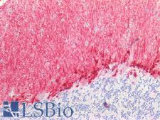 BMP6 Antibody - Human Brain, Cerebellum: Formalin-Fixed, Paraffin-Embedded (FFPE)