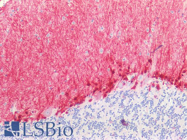 BMP6 Antibody - Human Brain, Cerebellum: Formalin-Fixed, Paraffin-Embedded (FFPE)