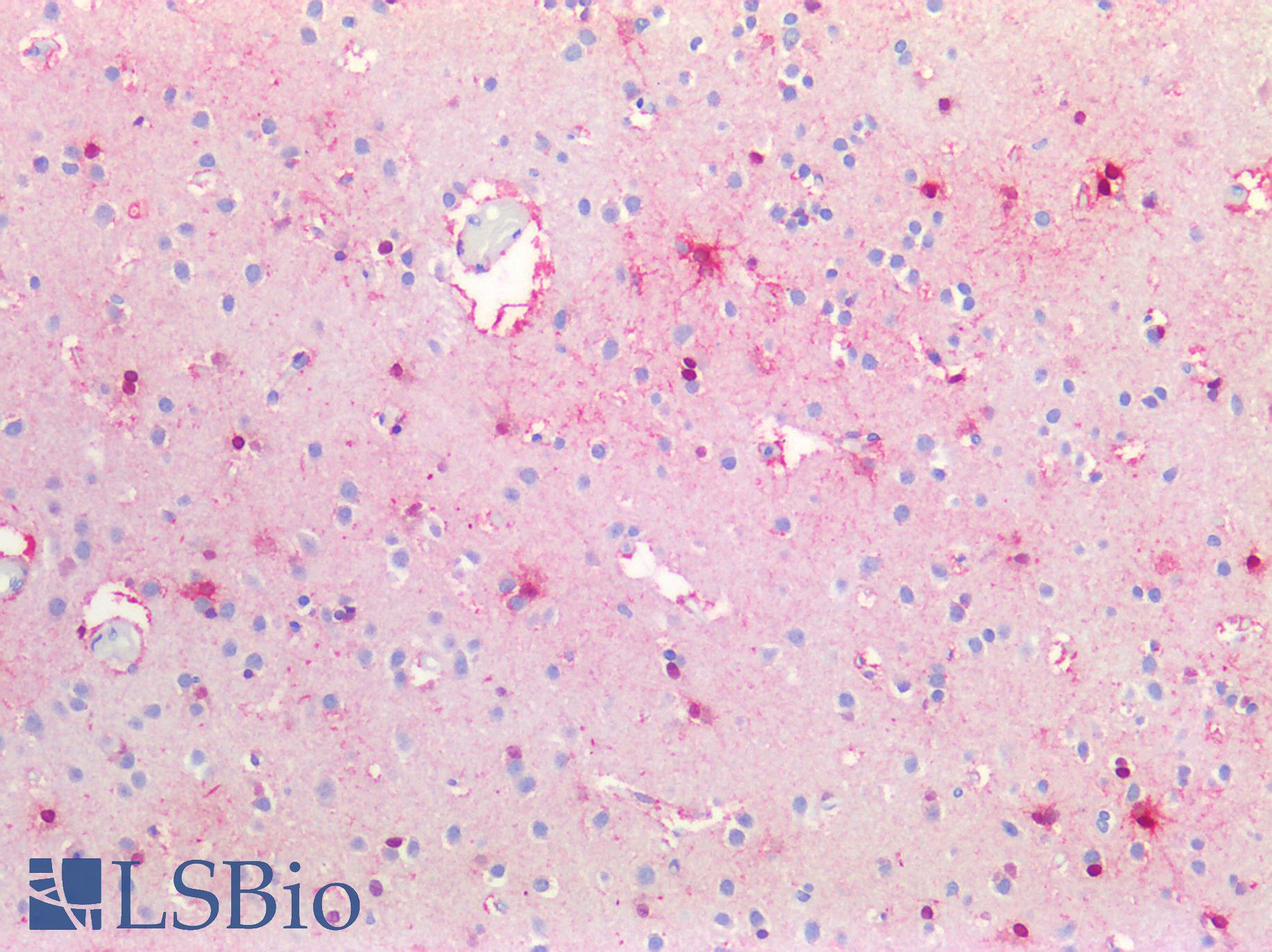 BMP6 Antibody - Human Brain, Cortex: Formalin-Fixed, Paraffin-Embedded (FFPE)