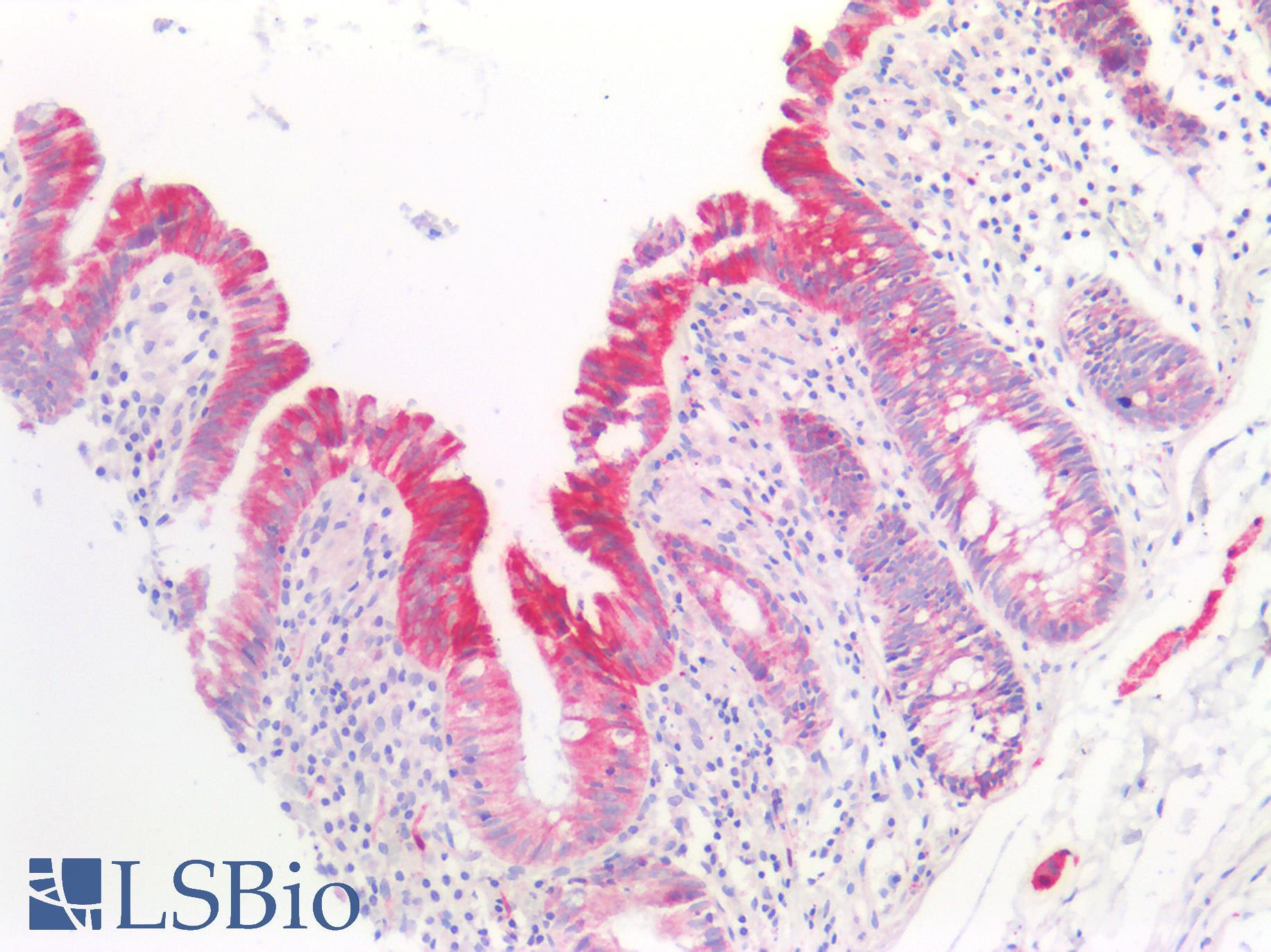 BMP6 Antibody - Human Small Intestine: Formalin-Fixed, Paraffin-Embedded (FFPE)