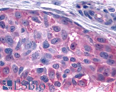 BOB / GPR15 Antibody - Skin, Melanoma