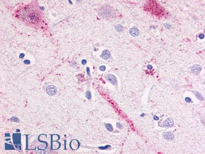 BOB / GPR15 Antibody - Brain, cortex, neurons