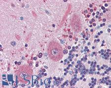 BRAF / B-Raf Antibody - Anti-BRAF antibody IHC of human brain, cerebellum. Immunohistochemistry of formalin-fixed, paraffin-embedded tissue after heat-induced antigen retrieval. Antibody dilution 1:200.