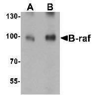 BRAF / B-Raf Antibody - Western blot analysis of B-raf in human brain tissue lysate with B-raf antibody at (A) 1 and (B) 2 ug/ml.