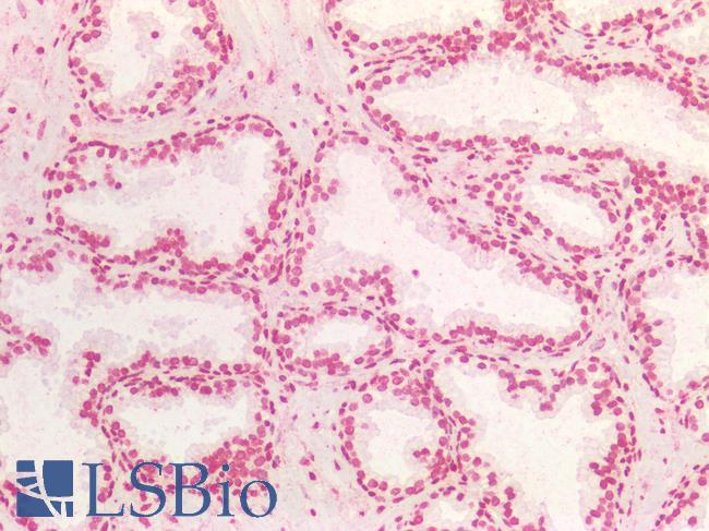 BRCA1 Antibody - Human Prostate: Formalin-Fixed, Paraffin-Embedded (FFPE)