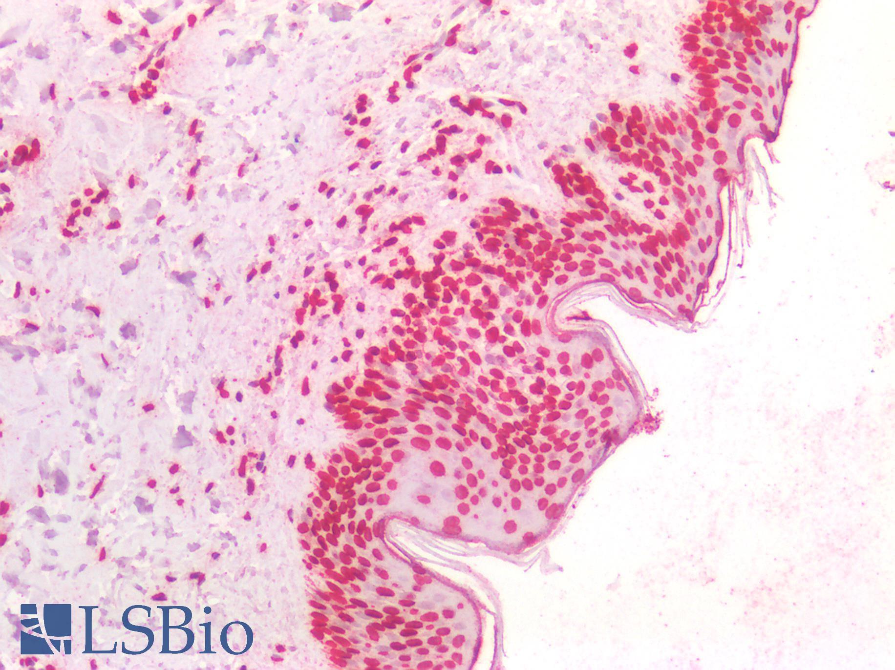 BRCA1 Antibody - Human Skin: Formalin-Fixed, Paraffin-Embedded (FFPE)