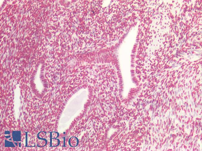 BRCA1 Antibody - Human Uterus: Formalin-Fixed, Paraffin-Embedded (FFPE)