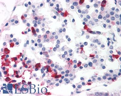 BRS3 Antibody - Pancreas, Islets of Langerhans