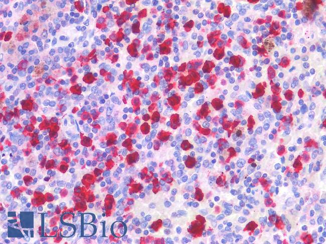 BTLA / CD272 Antibody - Human Spleen: Formalin-Fixed, Paraffin-Embedded (FFPE)