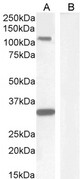 c-Kit / CD117 Antibody - c-Kit / CD117 antibody (1µg/ml) staining of Human Hippocampus lysate (A) + peptide (B) (35µg protein in RIPA buffer). Detected by chemiluminescence.