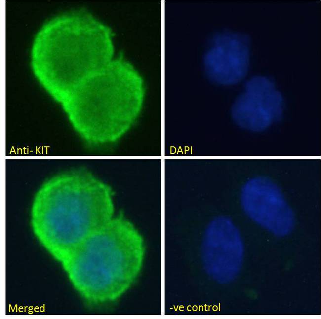 c-Kit / CD117 Antibody - c-Kit / CD117 antibody immunofluorescence analysis of paraformaldehyde fixed HEK293 cells, permeabilized with 0.15% Triton. Primary incubation 1hr (10ug/ml) followed by Alexa Fluor 488 secondary antibody (2ug/ml), showing cytoplasmic/membrane staining. The nuclear stain is DAPI (blue). Negative control: Unimmunized goat IgG (10ug/ml) followed by Alexa Fluor 488 secondary antibody (2ug/ml).