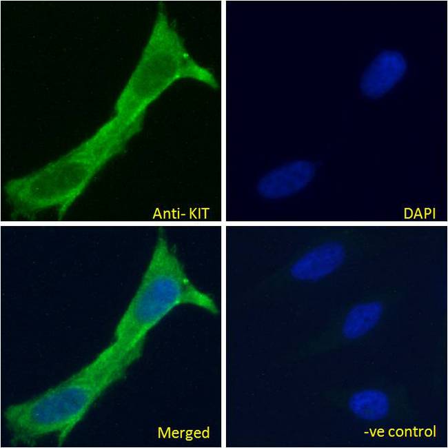 c-Kit / CD117 Antibody - c-Kit / CD117 antibody immunofluorescence analysis of paraformaldehyde fixed HeLa cells, permeabilized with 0.15% Triton. Primary incubation 1hr (10ug/ml) followed by Alexa Fluor 488 secondary antibody (2ug/ml), showing cytoplasmic/membrane staining. The nuclear stain is DAPI (blue). Negative control: Unimmunized goat IgG (10ug/ml) followed by Alexa Fluor 488 secondary antibody (2ug/ml).