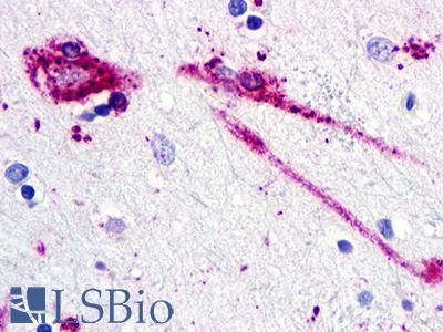 C5AR2 / GPR77 / C5L2 Antibody - Brain, Amygdala