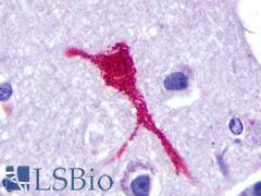 C5AR2 / GPR77 / C5L2 Antibody - Brain, Alzheimer's disease, neurofibrillary tangle