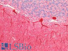 CALB1 / Calbindin Antibody - Human Brain, Cerebellum: Formalin-Fixed, Paraffin-Embedded (FFPE)