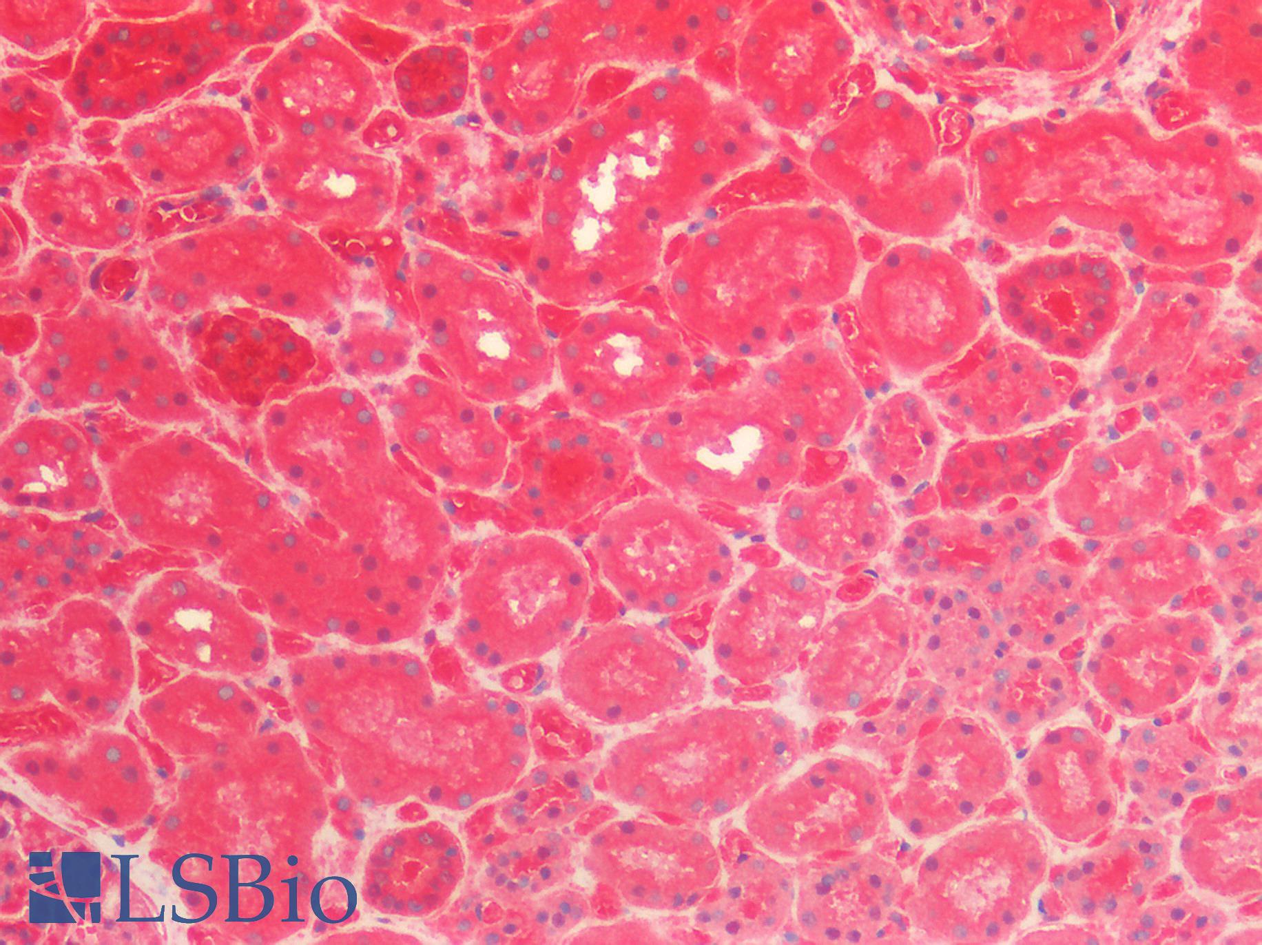 CALB1 / Calbindin Antibody - Human Kidney: Formalin-Fixed, Paraffin-Embedded (FFPE)