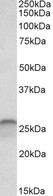 CALB1 / Calbindin Antibody - CALB1 / Calbindin antibody (0.03µg/ml) staining of Human Cerebellum lysate (35µg protein in RIPA buffer). Detected by chemiluminescence.