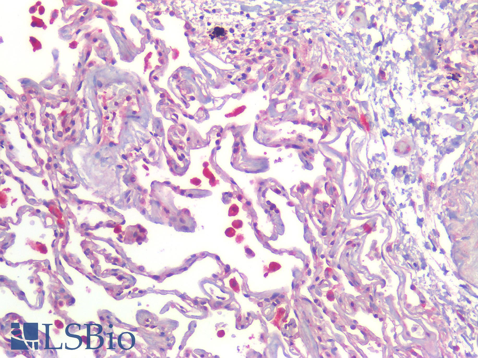 CALCRL / CGRP Receptor Antibody - Human Lung, Positive Staining in Macrophages: Formalin-Fixed, Paraffin-Embedded (FFPE)