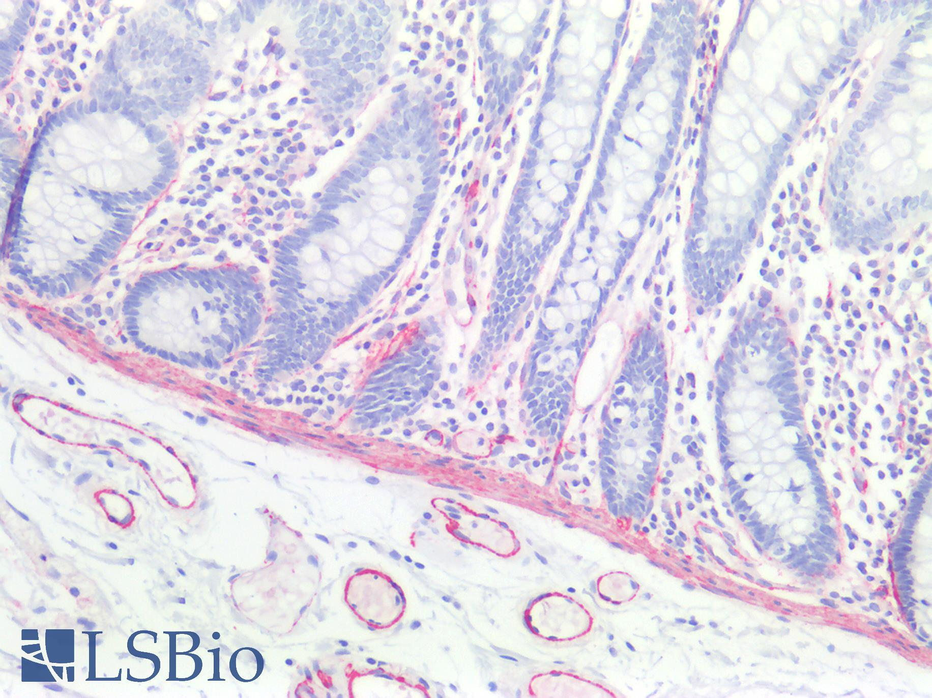CALD1 / Caldesmon Antibody - Human Colon, Smooth Muscle: Formalin-Fixed, Paraffin-Embedded (FFPE)