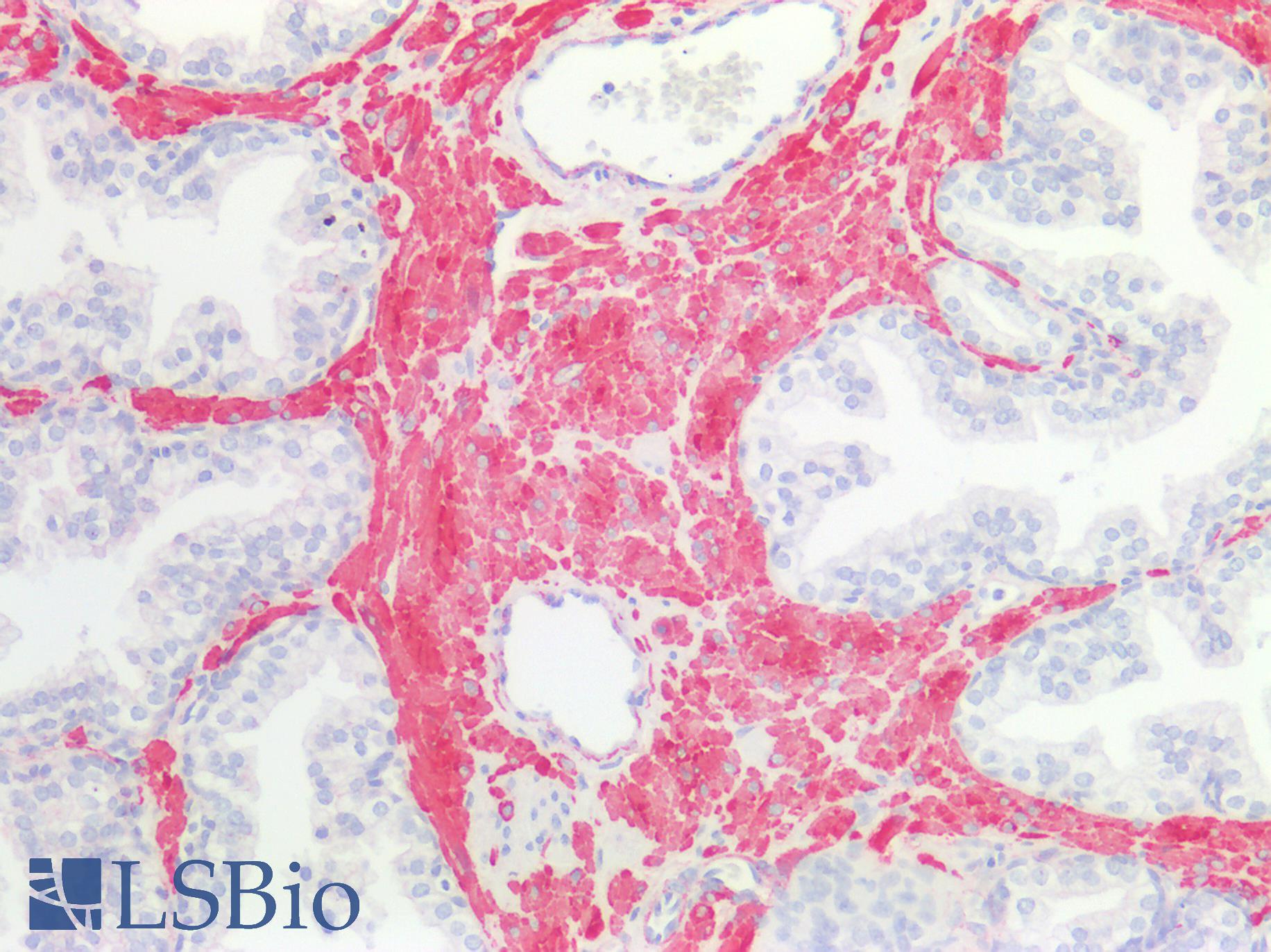 CALD1 / Caldesmon Antibody - Human Prostate, Smooth Muscle: Formalin-Fixed, Paraffin-Embedded (FFPE)