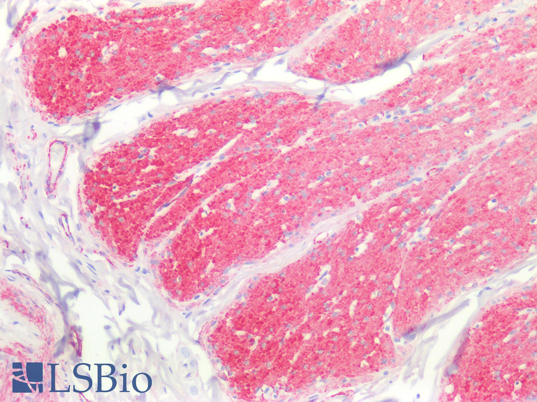 CALD1 / Caldesmon Antibody - Human Small Intestine, Smooth Muscle: Formalin-Fixed, Paraffin-Embedded (FFPE)