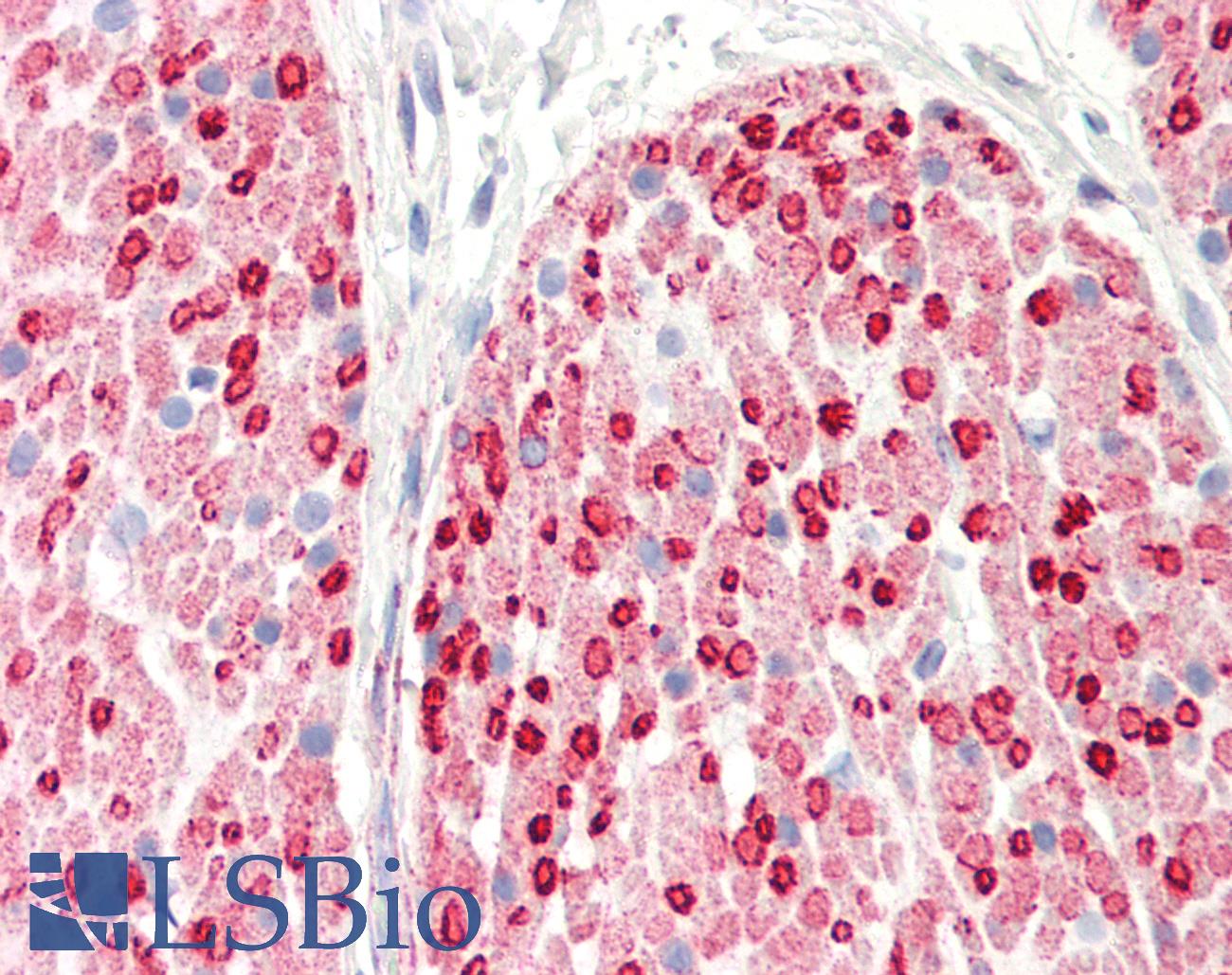 CALD1 / Caldesmon Antibody - Human Colon, Smooth Muscle: Formalin-Fixed, Paraffin-Embedded (FFPE)