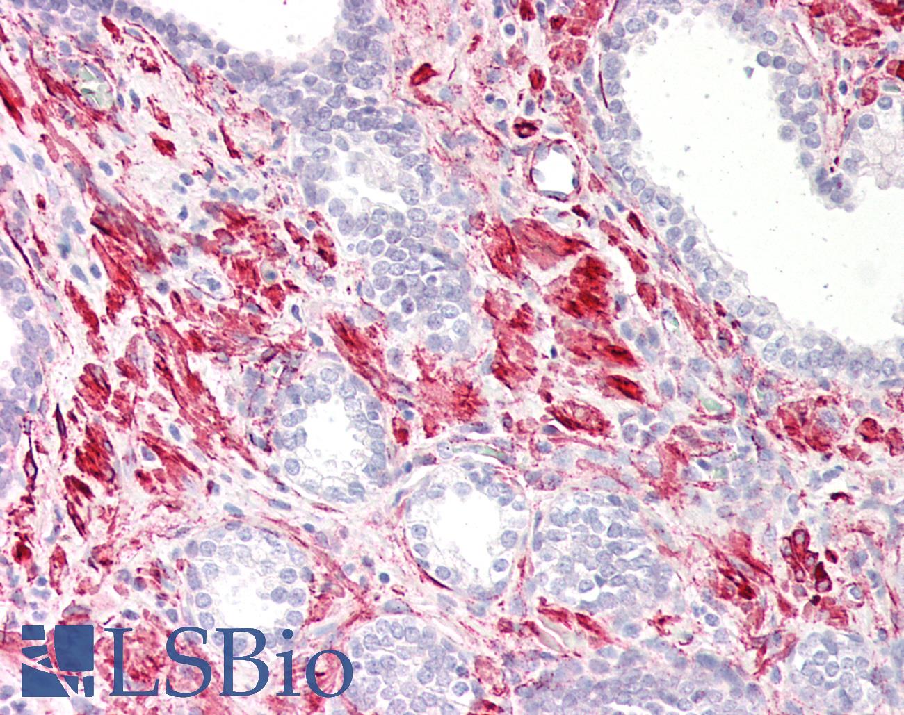 CALD1 / Caldesmon Antibody - Human Prostate: Formalin-Fixed, Paraffin-Embedded (FFPE)