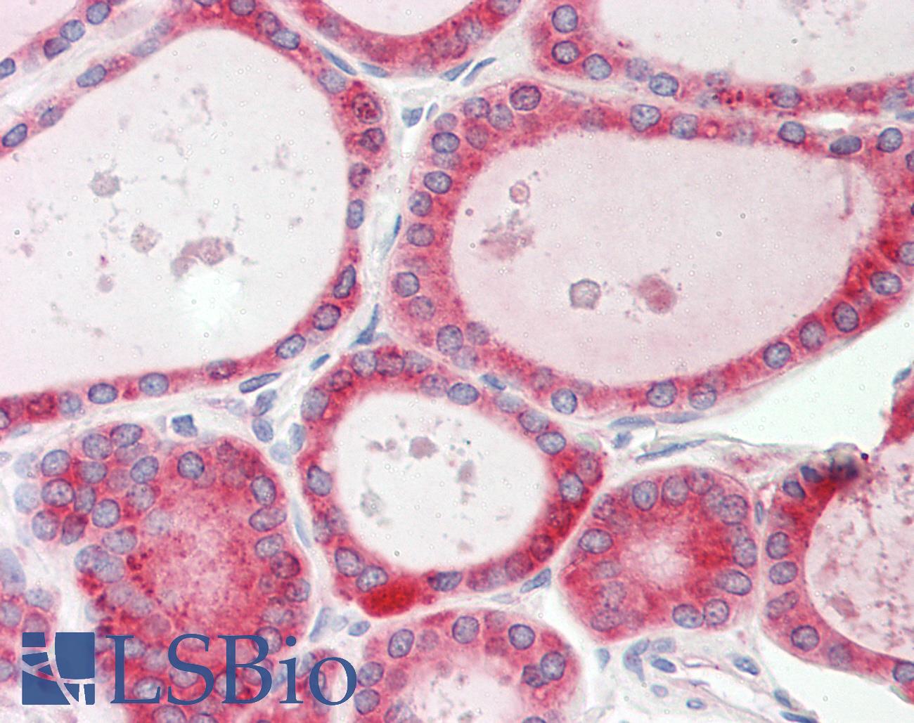 CALR / Calreticulin Antibody - Human Thyroid: Formalin-Fixed, Paraffin-Embedded (FFPE).  This image was taken for the unconjugated form of this product. Other forms have not been tested.
