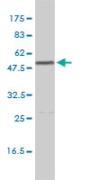CALR / Calreticulin Antibody - Western blot of CALR expression in K-562 by CALR monoclonal antibody (M01), clone 1G11-1A9.
