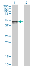 CALR / Calreticulin Antibody - Western blot of CALR expression in transfected 293T cell line by CALR monoclonal antibody (M01), clone 1G11-1A9.