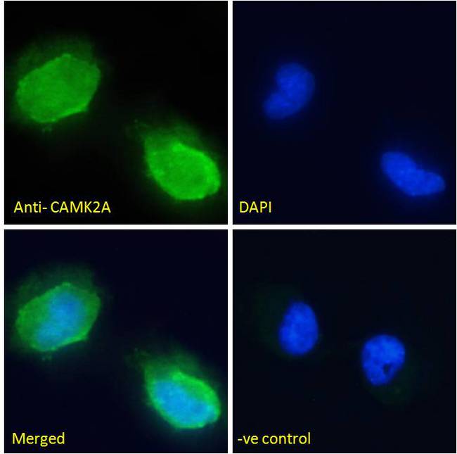CAMK2A / CaMKII Alpha Antibody - Immunofluorescence analysis of paraformaldehyde fixed U251 cells, permeabilized with 0.15% Triton. Primary incubation 1hr (10ug/ml) followed by Alexa Fluor 488 secondary antibody (2ug/ml), showing membrane staining. The nuclear stain is DAPI (blue