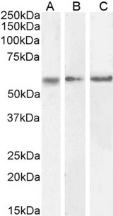 CAMK2A / CaMKII Alpha Antibody - Goat Anti-CAMK2A Antibody (0.3µg/ml) staining of Human Cerebellum (A), Mouse (B) and Rat (C) Brain lysate (35µg protein in RIPA buffer). Detected by chemiluminescencence