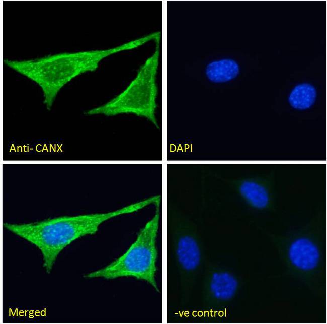 CANX / Calnexin Antibody - CANX / Calnexin antibody immunofluorescence analysis of paraformaldehyde fixed NIH3T3 cells, permeabilized with 0.15% Triton. Primary incubation 1hr (5ug/ml) followed by Alexa Fluor 488 secondary antibody (2ug/ml), showing cytoplasmic staining. The nuclear stain is DAPI (blue). Negative control: Unimmunized goat IgG (10ug/ml) followed by Alexa Fluor 488 secondary antibody (2ug/ml).