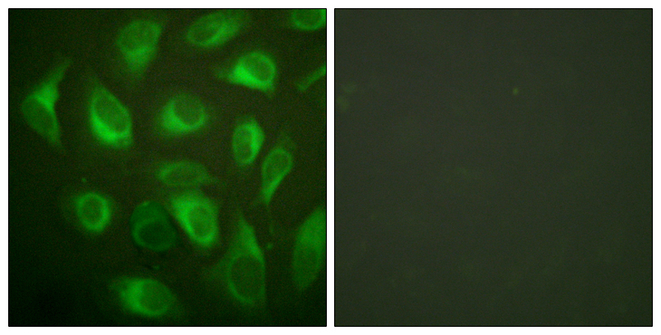 CANX / Calnexin Antibody - Immunofluorescence analysis of HeLa cells, using Calnexin Antibody. The picture on the right is blocked with the synthesized peptide.