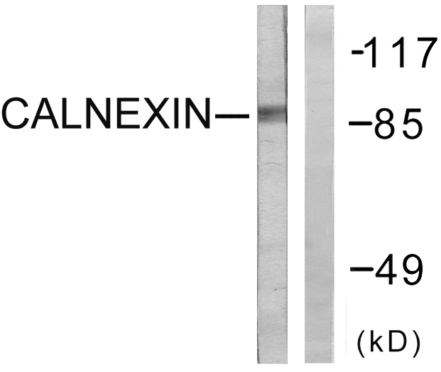 CANX / Calnexin Antibody - Western blot analysis of lysates from HeLa cells, treated with EGF 200ng/ml 30', using Calnexin Antibody. The lane on the right is blocked with the synthesized peptide.