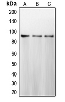 CANX / Calnexin Antibody - Western blot analysis of Calnexin expression in MCF7 (A); HeLa (B); MDAMB231 (C) whole cell lysates.