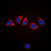 CANX / Calnexin Antibody - Immunofluorescent analysis of Calnexin staining in HeLa cells. Formalin-fixed cells were permeabilized with 0.1% Triton X-100 in TBS for 5-10 minutes and blocked with 3% BSA-PBS for 30 minutes at room temperature. Cells were probed with the primary antibody in 3% BSA-PBS and incubated overnight at 4 C in a humidified chamber. Cells were washed with PBST and incubated with a DyLight 594-conjugated secondary antibody (red) in PBS at room temperature in the dark. DAPI was used to stain the cell nuclei (blue).