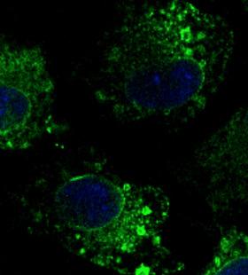 CANX / Calnexin Antibody - Immunofluorescence - anti-CANX antibody in Hepa1-6 cells at 1:100 dilution. Cells were fixed with 4% of PFA.