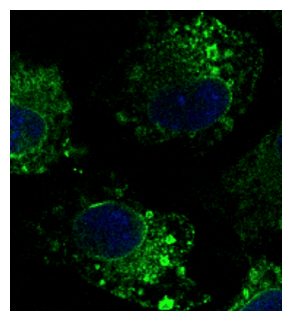 CANX / Calnexin Antibody - Immunofluorescence - anti-CANX Ab in Hepa1-6 cells at 1:100 dilution; cells were fixed with 4% of PFA
