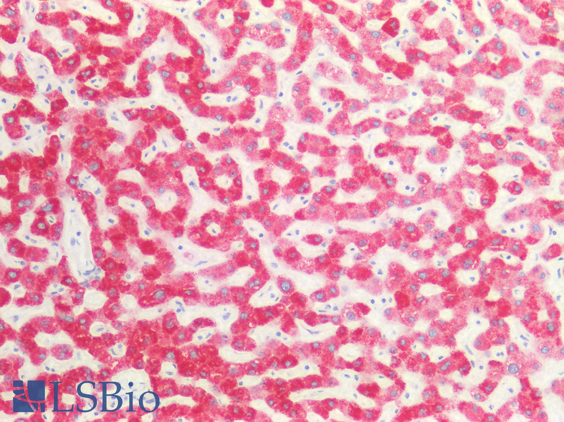 CANX / Calnexin Antibody - Human Liver: Formalin-Fixed, Paraffin-Embedded (FFPE)