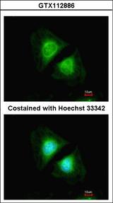CANX / Calnexin Antibody - Immunofluorescence of methanol-fixed HeLa, using Calnexin antibody at 1:200 dilution.
