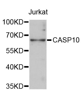 CASP10 / Caspase 10 Antibody - Western blot analysis of extracts of Jurkat cells, using CASP10 antibody at 1:3000 dilution. The secondary antibody used was an HRP Goat Anti-Rabbit IgG (H+L) at 1:10000 dilution. Lysates were loaded 25ug per lane and 3% nonfat dry milk in TBST was used for blocking. An ECL Kit was used for detection and the exposure time was 90s.