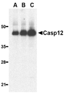 CASP12 / Caspase 12 Antibody - Western blot of caspase-12 in human heart lysate with caspase-12 antibody at 0.5 (lane A), 1 (lane B), and 2 ug/ml (lane C), respectively.