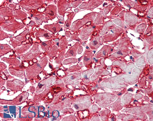 CASP12 / Caspase 12 Antibody - Anti-CASP12 / Caspase 12 antibody IHC of human heart. Immunohistochemistry of formalin-fixed, paraffin-embedded tissue after heat-induced antigen retrieval. Antibody concentration 5 ug/ml.