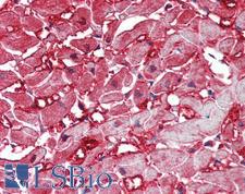 CASP12 / Caspase 12 Antibody - Anti-CASP12 / Caspase 12 antibody IHC of human heart. Immunohistochemistry of formalin-fixed, paraffin-embedded tissue after heat-induced antigen retrieval. Antibody concentration 5 ug/ml.