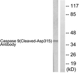 CASP9 / Caspase 9 Antibody - Western blot of extracts from 293 cells, treated with Etoposide 25 uM 60', using Caspase 9 (Cleaved-Asp315) Antibody. The lane on the right is treated with the synthesized peptide.