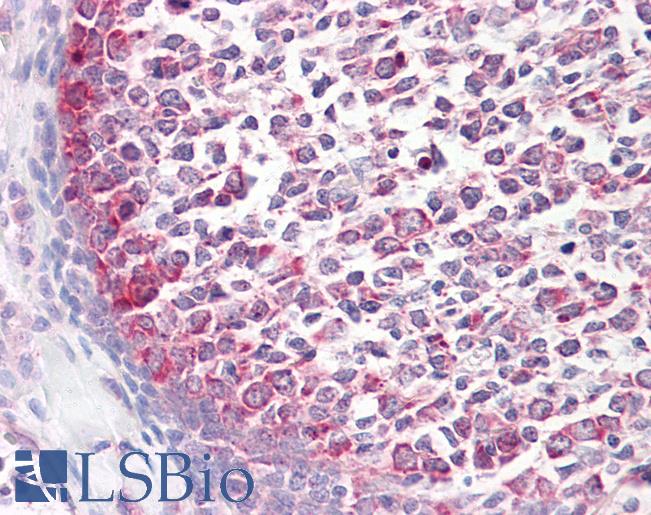 CASP9 / Caspase 9 Antibody - Anti-Caspase 9 antibody IHC of human tonsil. Immunohistochemistry of formalin-fixed, paraffin-embedded tissue after heat-induced antigen retrieval. Antibody dilution 10 ug/ml.